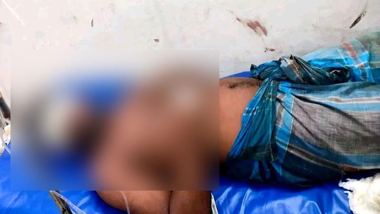 ভোলায় যুবককে তুলে নিয়ে দুই চোখ উপড়ে ফেলল প্রতিপক্ষ