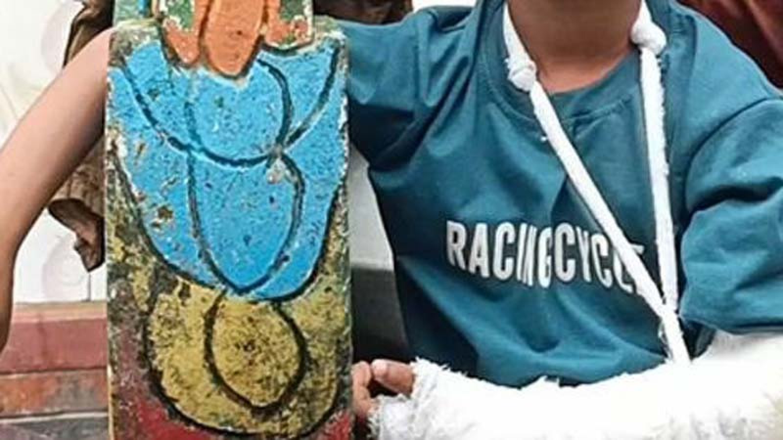 শিক্ষকের বেতের আঘাতে’ হাত ফাটলো মাদ্রাসা ছাত্রের, মুখে গোঁজা হয় কলম