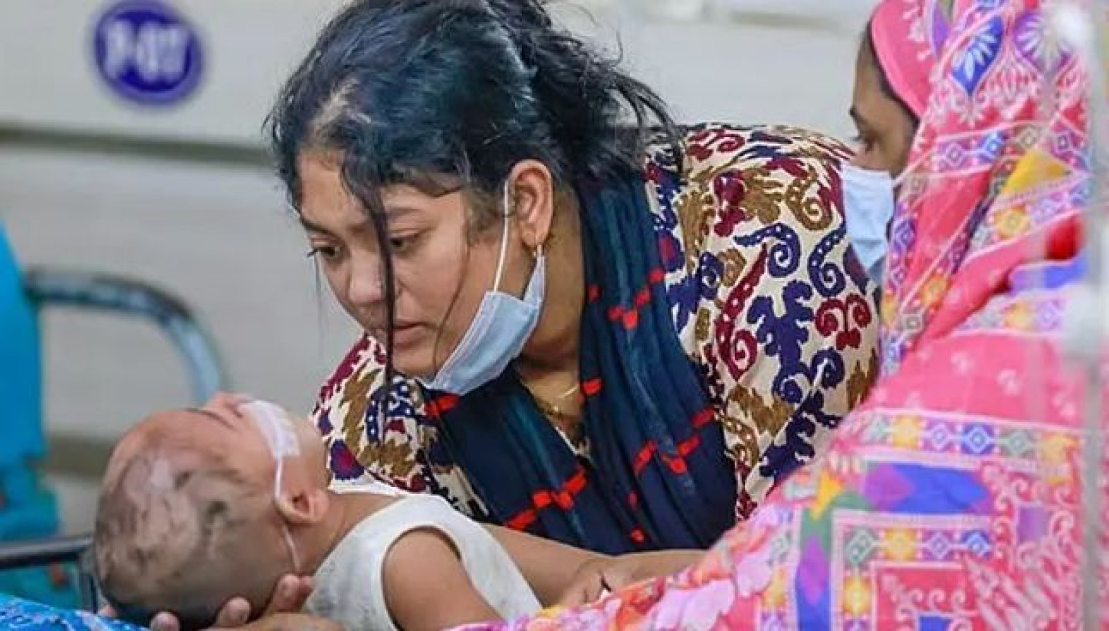 হাম ও হামের উপসর্গে শিশুমৃত্যু হাজার ছুঁই ছুঁই
