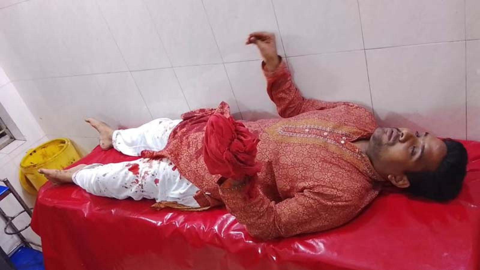 সান্তাহারে জুয়েলার্সে ঢুকে ব্যবসায়ীকে ছুরিকাঘাত, স্বর্ণালংকার লুটের মামমলা দায়ের