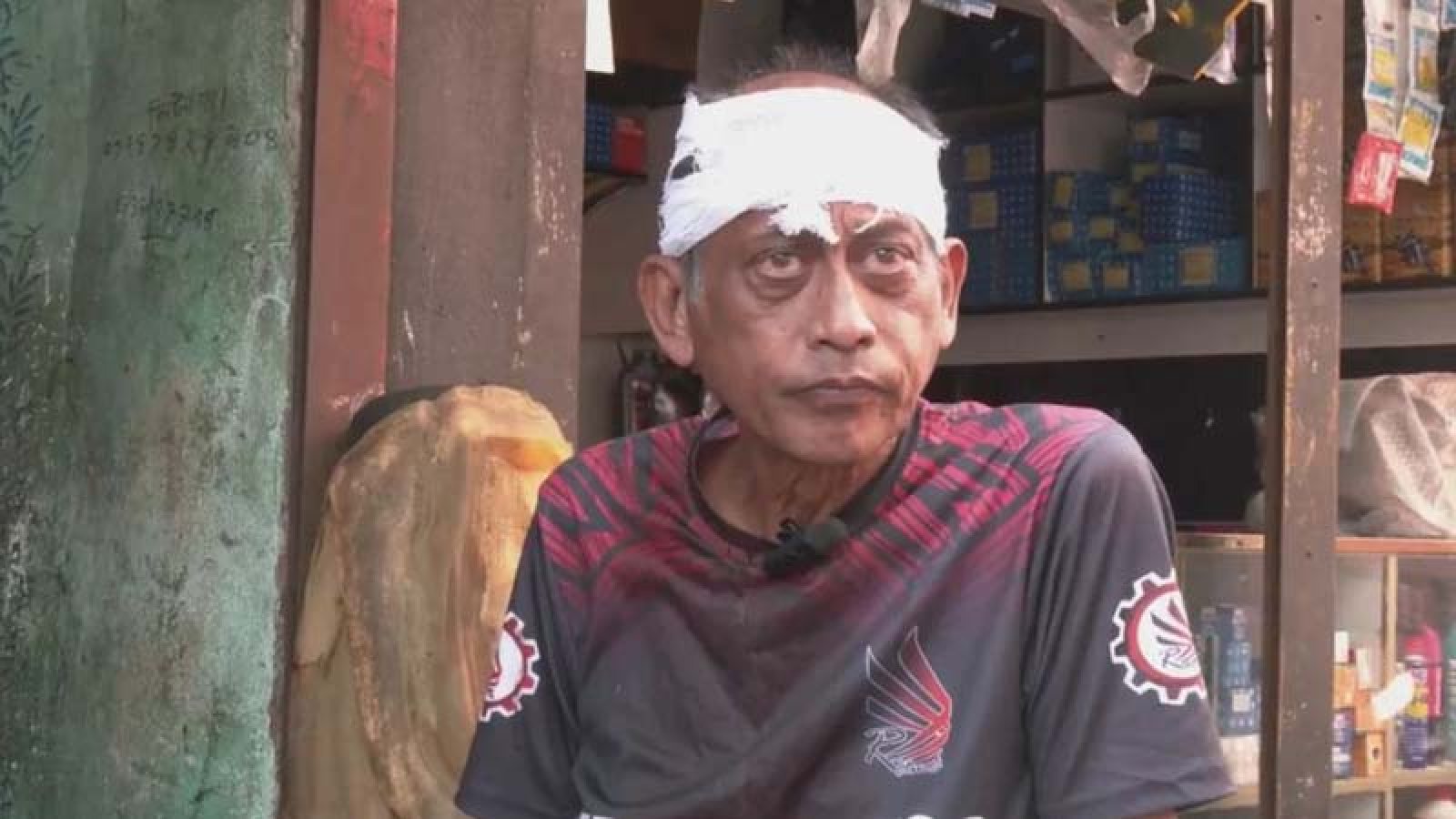 নিজ বাসার সামনে হামলার শিকার অভিনেতা, ফাটিয়ে দিলো মাথা