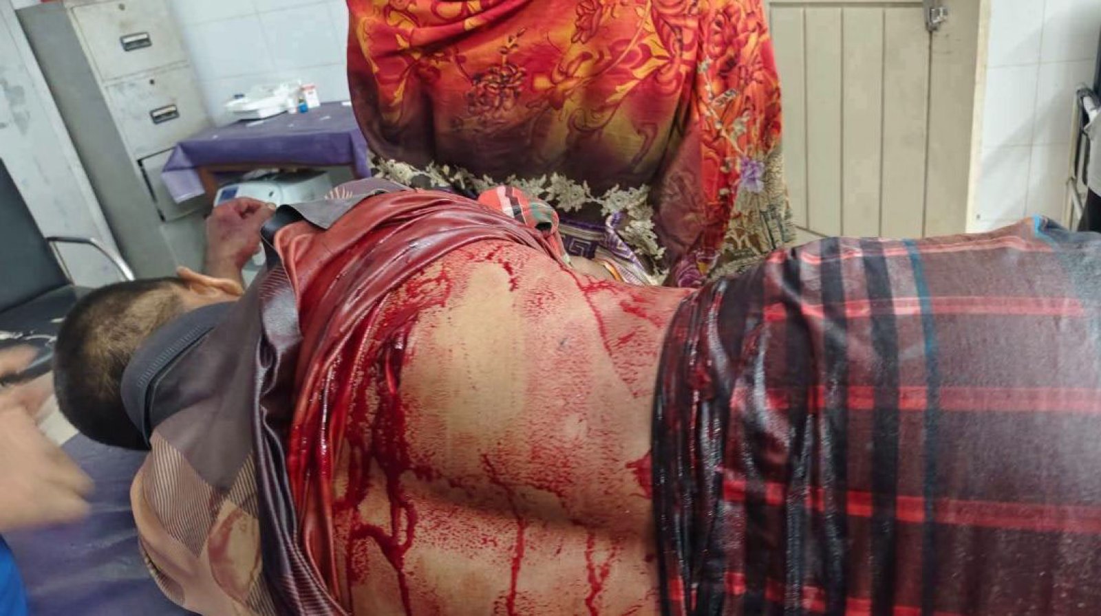 শিবগঞ্জ-গোমস্তাপুর সড়কে ডাকাতদের হামলায় সবজি ব্যবসায়ী আহত
