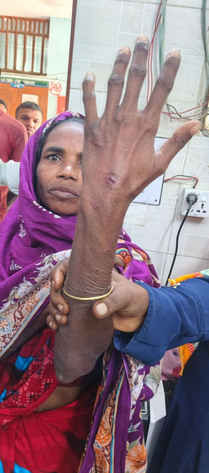সাপাহারে শিয়ালের কামড়ে নারী-শিশুসহ আহত ৩