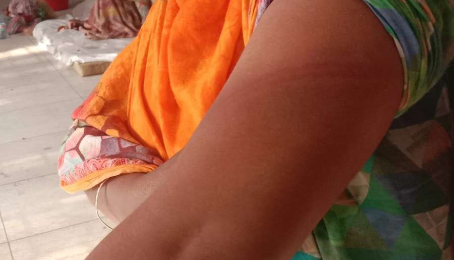 সাপাহারে গৃহবধূকে মারপিট ও শ্লীলতাহানির অভিযোগ, হাসপাতালে ভর্তি
