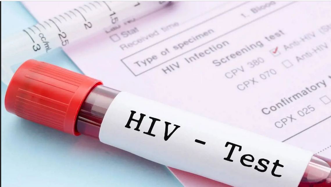 AIDS নিয়ন্ত্রণে পাকাপাকি সমাধান? গবেষণায় বড় অগ্রগতি বিজ্ঞানীদের