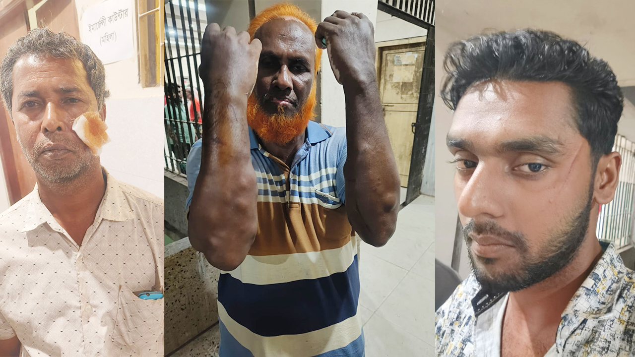 নলডাঙ্গায় মুখোশধারী দুর্বৃত্তদের হামলা সাবেক উপজেলা চেয়ারম্যানসহ বিএনপির ৭ নেতা-কর্মী আহত