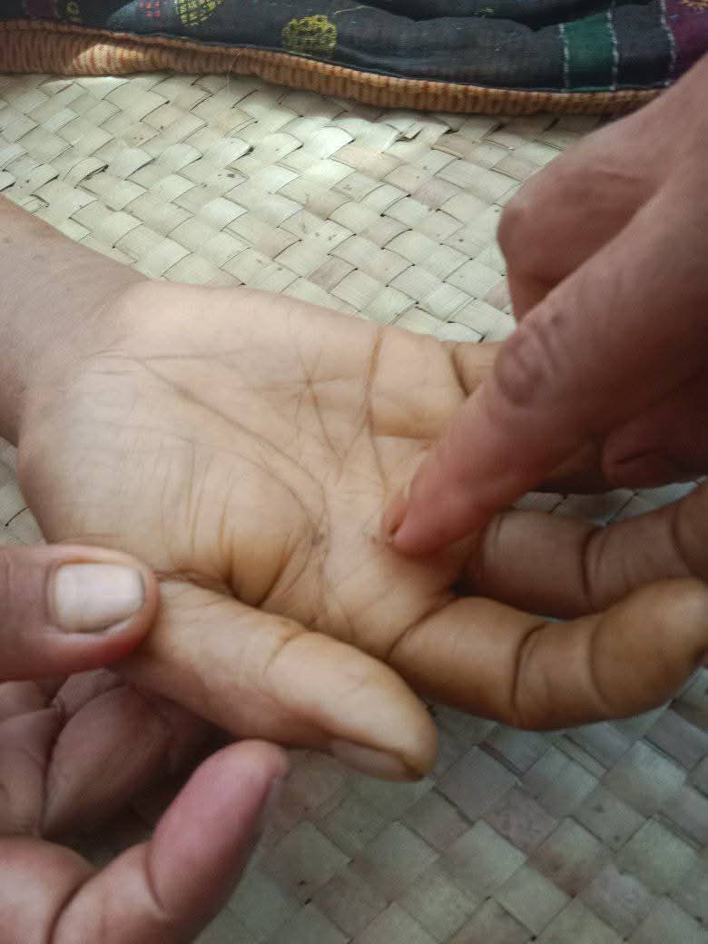 বড়াইগ্রামে সাপের কামড়ে গৃহবধূর মৃত্যু