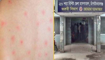 চাঁপাইনবাবগঞ্জ সদর হাসপাতালে হামের উপসর্গ নিয়ে ২৭ শিশু ভর্তি