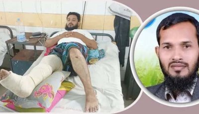 চাঁদা না দেওয়ায় ব্যবসায়ীর পা ভেঙে দিলেন যুবদল নেতা