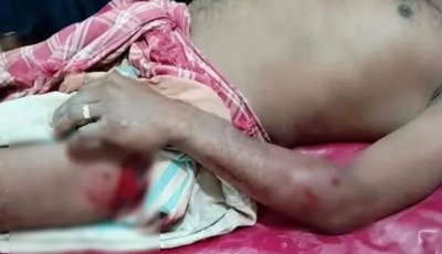 কুষ্টিয়ায় শরীরে পেরেক ঢুকিয়ে মধ্যযুগীয় কায়দায় নির্যাতনের অভিযোগ