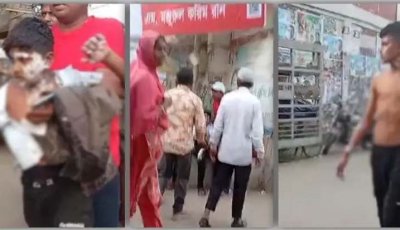 বিএনপির গণমিছিলের প্রস্তুতিকালে গ্যাস বেলুন বিস্ফোরণে অর্ধশতাধিক দগ্ধ