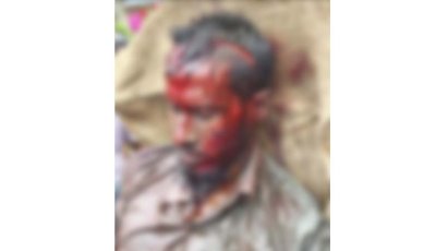 তানোরে হামলার ঘটনায় মামলা, আসামিরা এখনো ধরাছোঁয়ার বাইরে